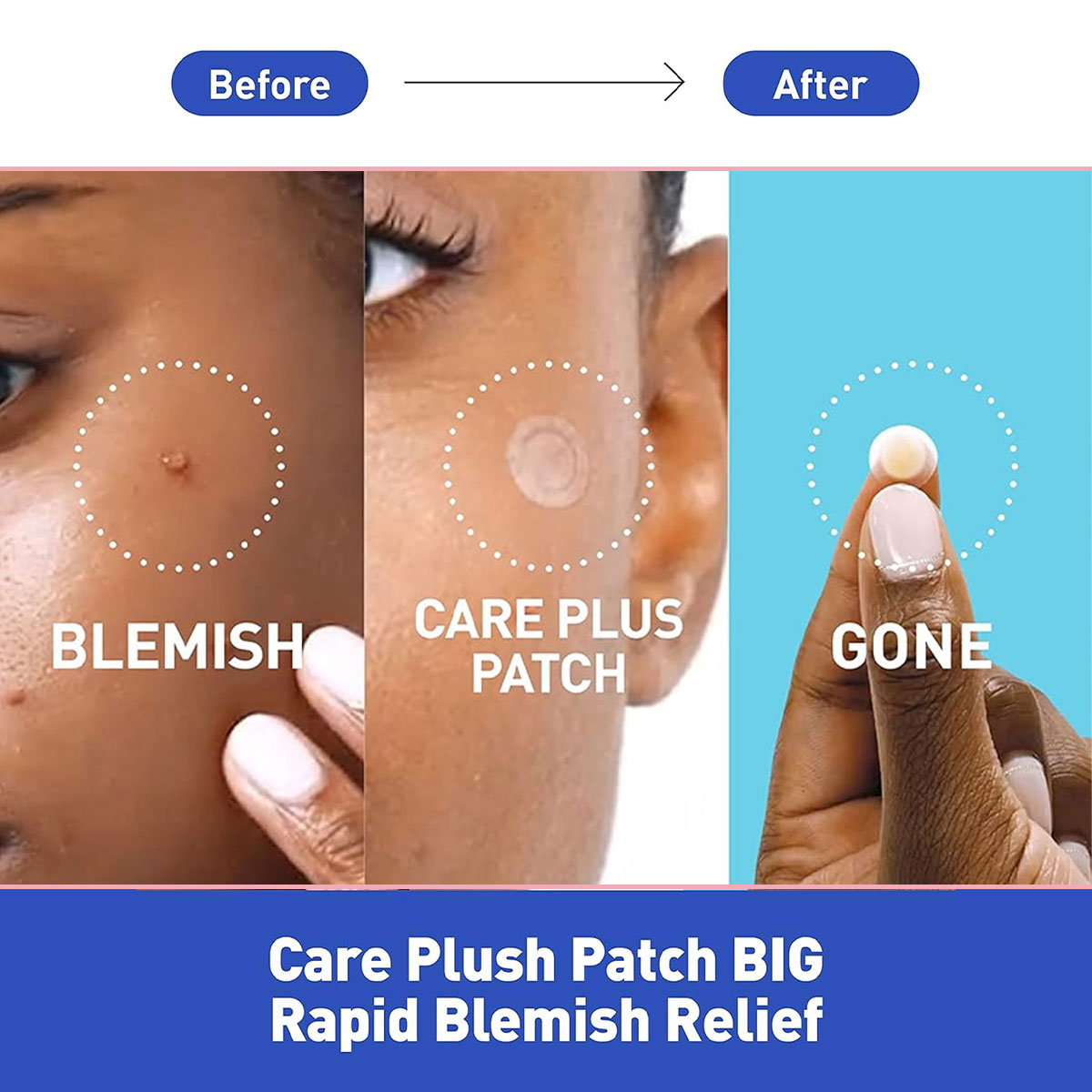 Olive Young Care Plus Spot Cov - огляд і ціна Korean Lifestyle