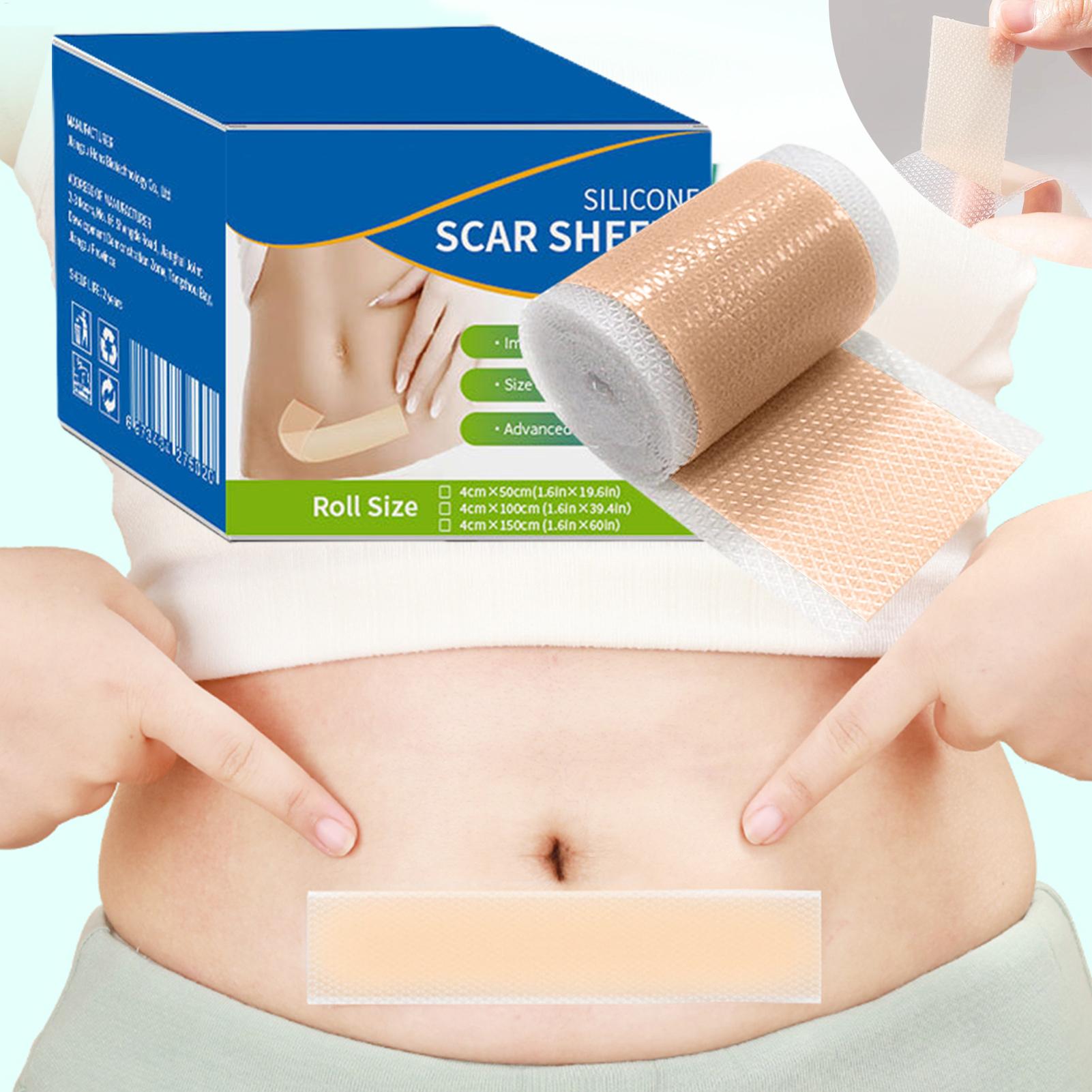 1 Roll Silicone Scar Sheets 4c - огляд і ціна Sheet Mask Collagen